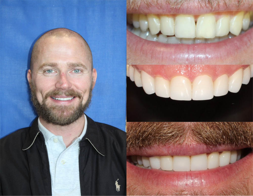 Jeansonne   Spillers Dentistry | Cosmetic Dentistry, Emergency Treatment and Ceramic Crowns