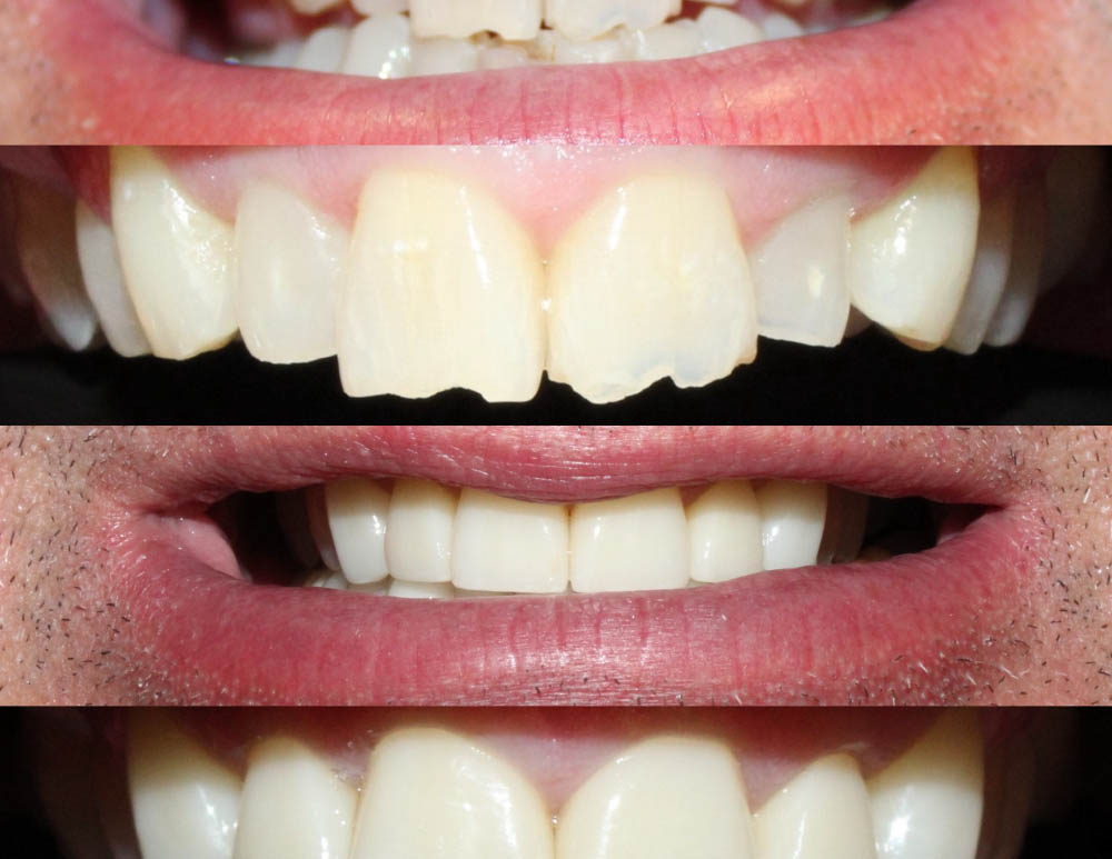 Jeansonne   Spillers Dentistry | Periodontal Treatment, Snoring Appliances and Digital Radiography